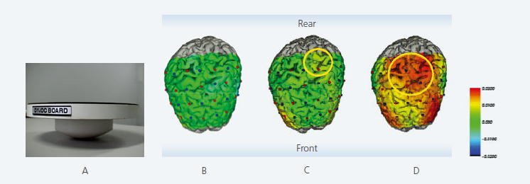 Brain Activity during Upright Posture Control