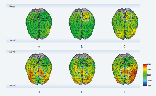 Brain Activity for Muscle Force Control during Right Knee Extension Movements