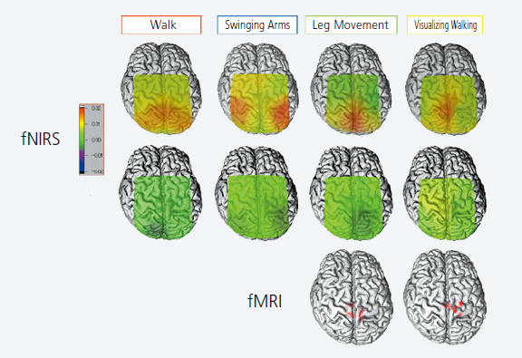 fNIRS Measurement of Brain Activation while Walking on a Treadmill