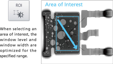 Image Adjustment Functions (Auto Window Function and Area of Interest Function)